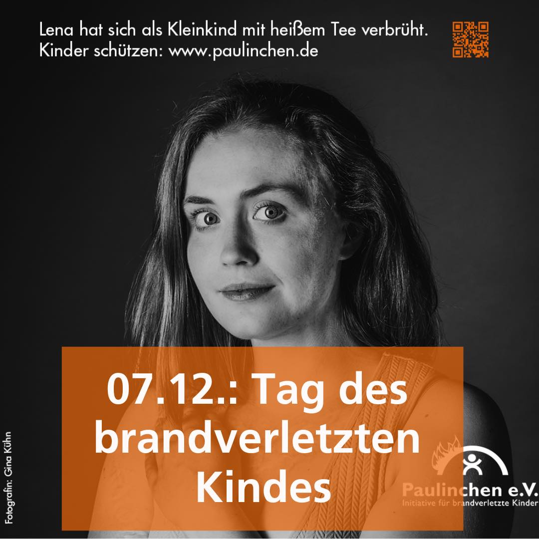 Tag des brandverletzten Kindes